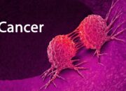 Cancer Detection Speeds Up: Physics Joins the Diagnostic Team