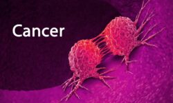 Cancer Detection Speeds Up: Physics Joins the Diagnostic Team