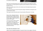 What’s an MRI scan? How will it be?