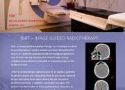 What is IGRT in radiation therapy?