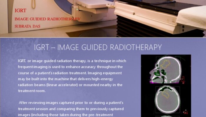 What is IGRT in radiation therapy?