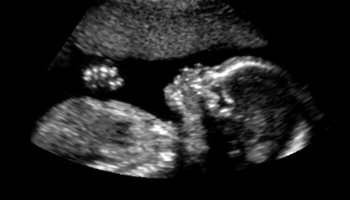 Crystal Phase Change Saves Lives: Warming Premature Babies with Science