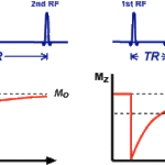 How much stronger is an MRI signal than that of the Earth?