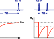 How much stronger is an MRI signal than that of the Earth?