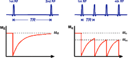 How much stronger is an MRI signal than that of the Earth?