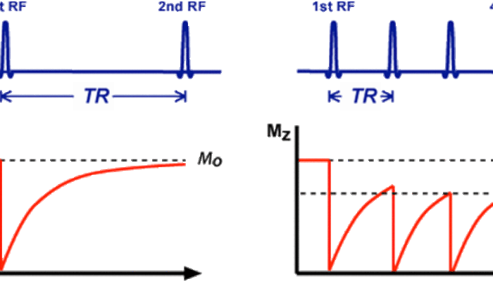 How much stronger is an MRI signal than that of the Earth?