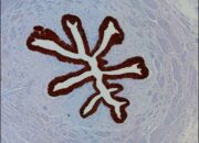 Microbe vs. Flow: Bacterium Battles Against the Current