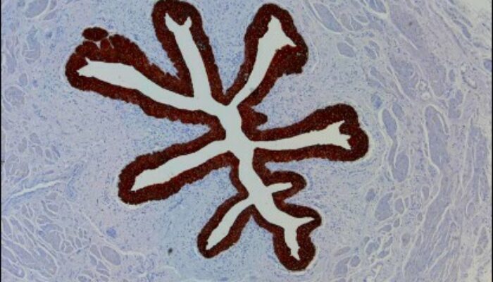 Bacterium Battles the Current: Swimming Against the Microfluidic Stream