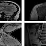 What is Magnetic Resonance Imaging (MRI)?