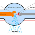 Shining a Light on the Dark Field: A New View in X-ray Imaging