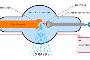 Shining a Light on the Dark Field: A New View in X-ray Imaging