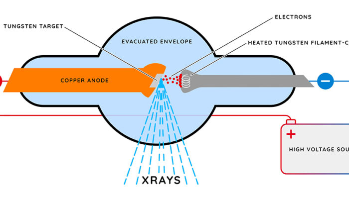Shining a Light on the Dark Field: A New View in X-ray Imaging