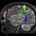 Magnetic Resonance Imaging: Is fMRI bad for your health?