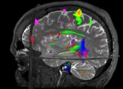 Magnetic Resonance Imaging: Is fMRI bad for your health?