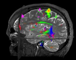 Magnetic Resonance Imaging: Is fMRI bad for your health?