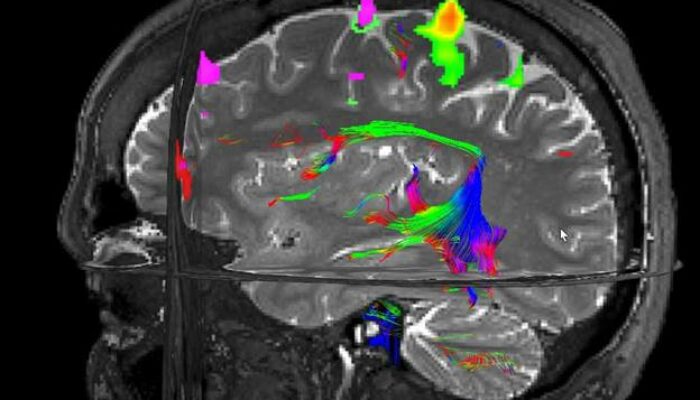 Magnetic Resonance Imaging: Is fMRI bad for your health?