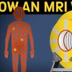 How to operate an MRI machine?