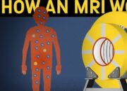 How to operate an MRI machine?