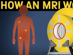 How to operate an MRI machine?