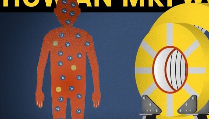 How to operate an MRI machine?