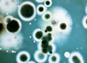 Microbiology Majors: Two Perfect Minors to Elevate Your Degree