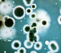 Microbiology Majors: Two Perfect Minors to Elevate Your Degree