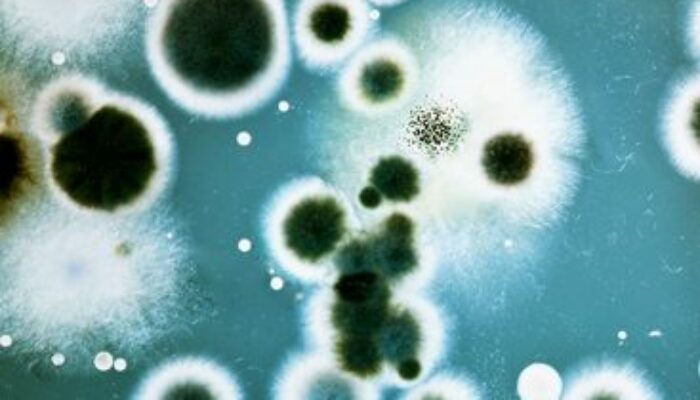 Microbiology Majors: Two Perfect Minors to Elevate Your Degree